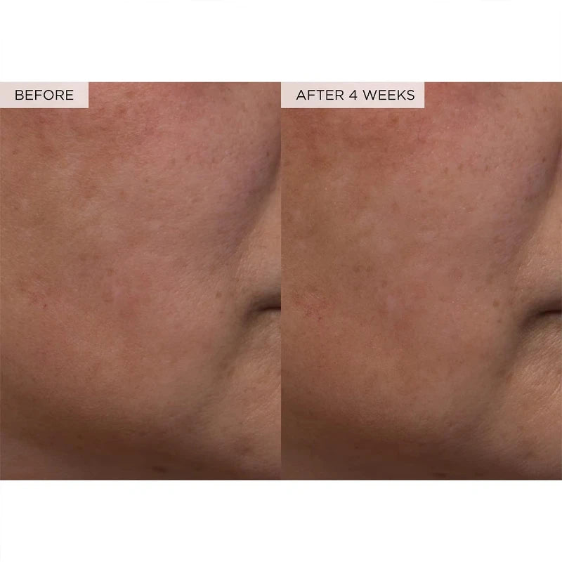 GlowMelon Brightening Face Toner – Pore Minimizer with Hyaluronic Acid & Niacinamide
