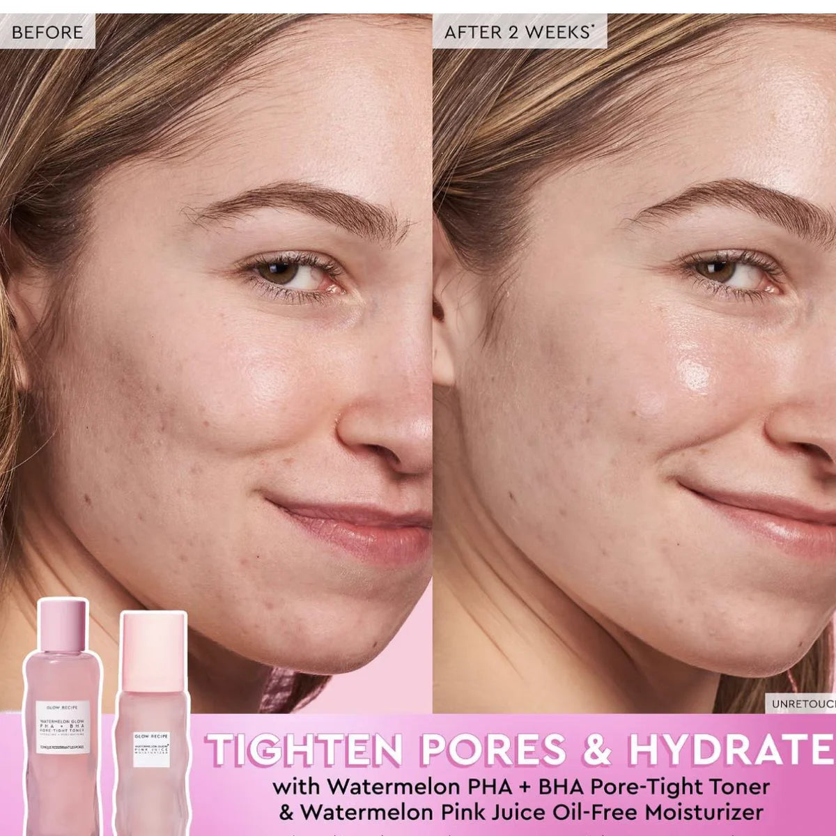 GlowMelon Brightening Face Toner – Pore Minimizer with Hyaluronic Acid & Niacinamide