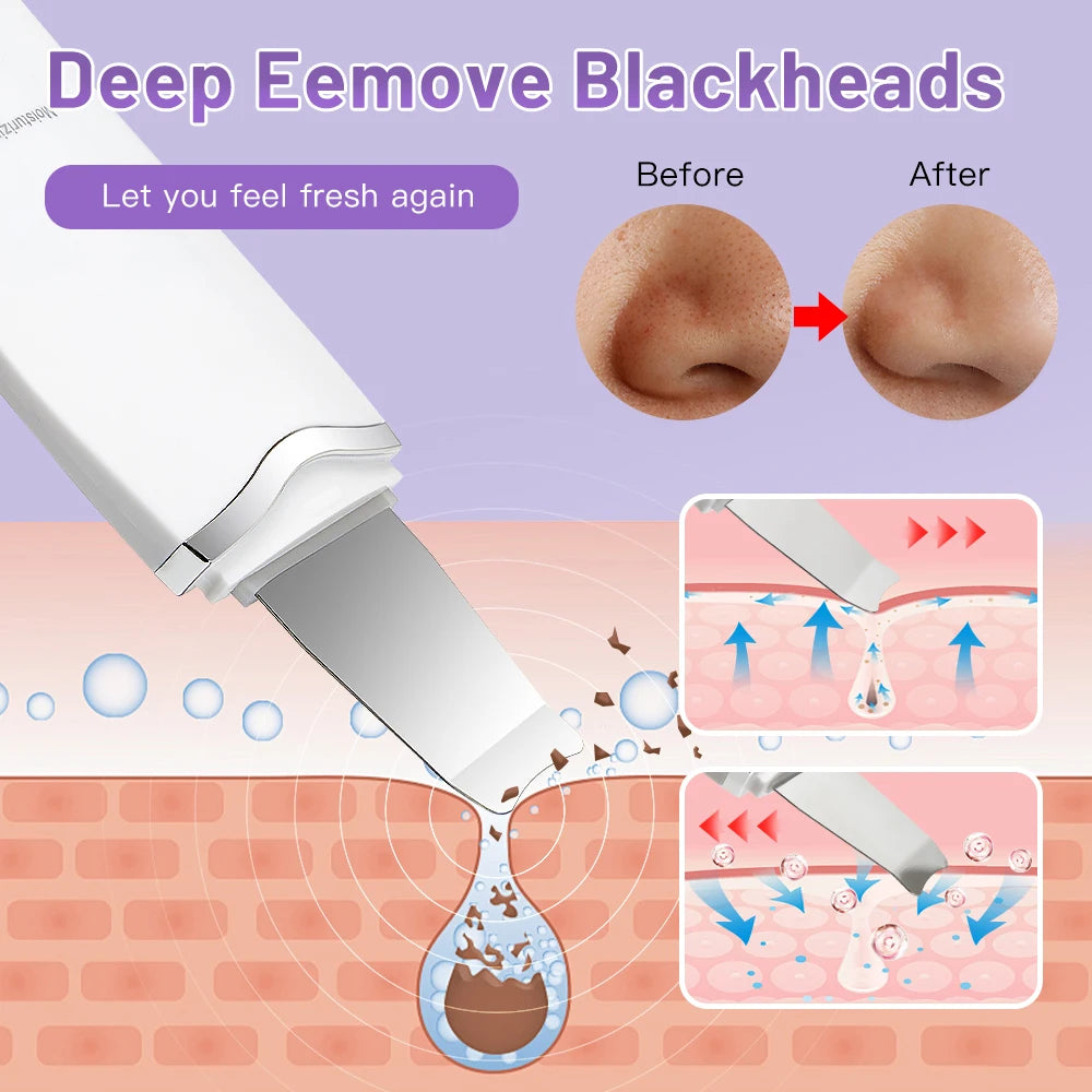 LumiSkin Ultrasonic Facial Scrubber – Deep Cleansing, Blackhead Remover & Skin Lifting Tool