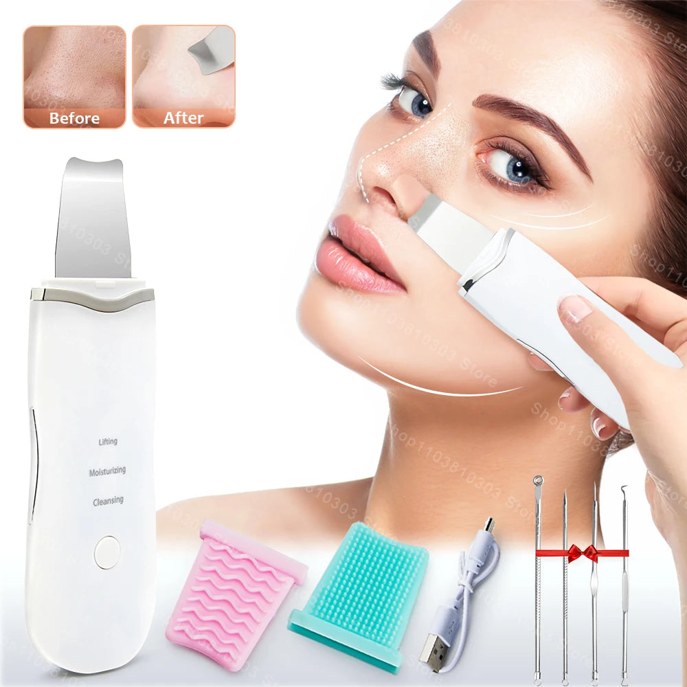 LumiSkin Ultrasonic Facial Scrubber – Deep Cleansing, Blackhead Remover & Skin Lifting Tool